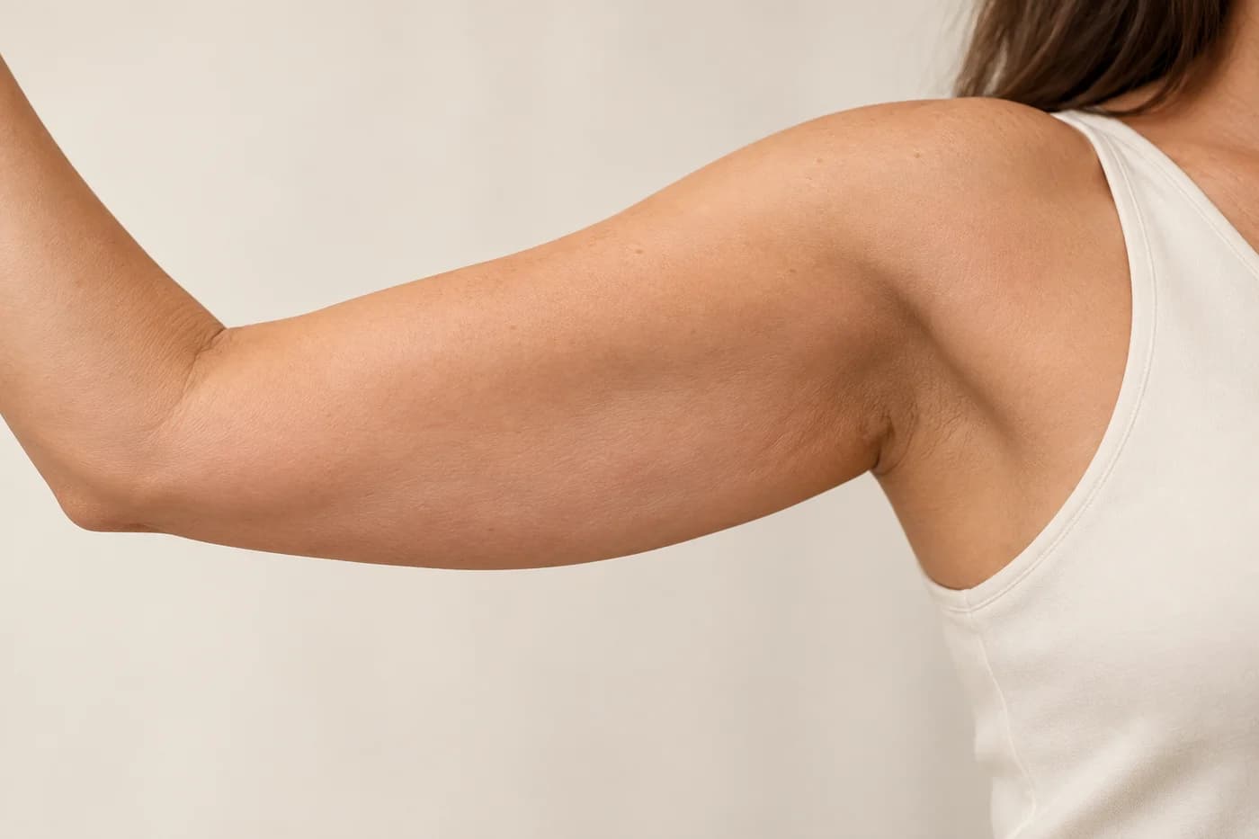 Upper arms