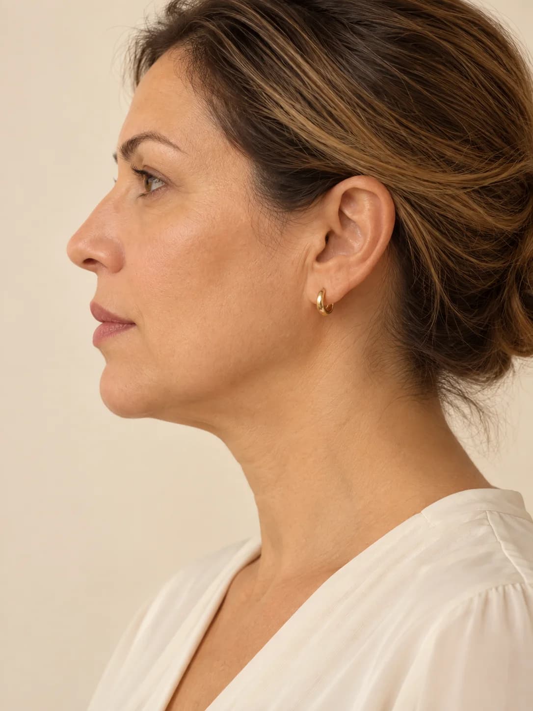 Treatment focus: skin along the jawline and fullness beneath the chin